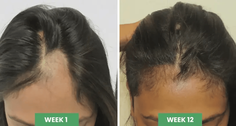 Aceite Crecimiento Capilar Batana – Hoshi Guatemala