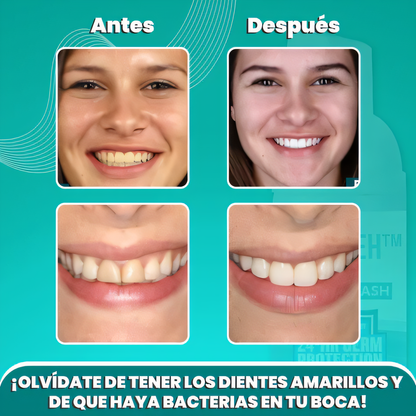 Espuma de Dientes Blanqueadora y Anti Bacterias