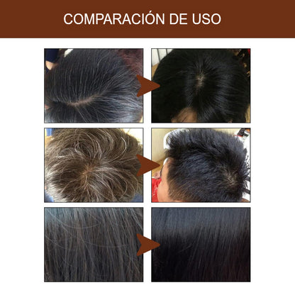 Shampoo En Barra Anti Canas