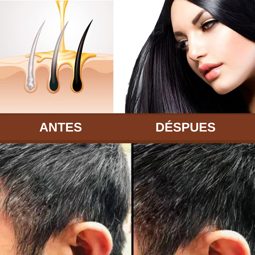 Shampoo En Barra Anti Canas